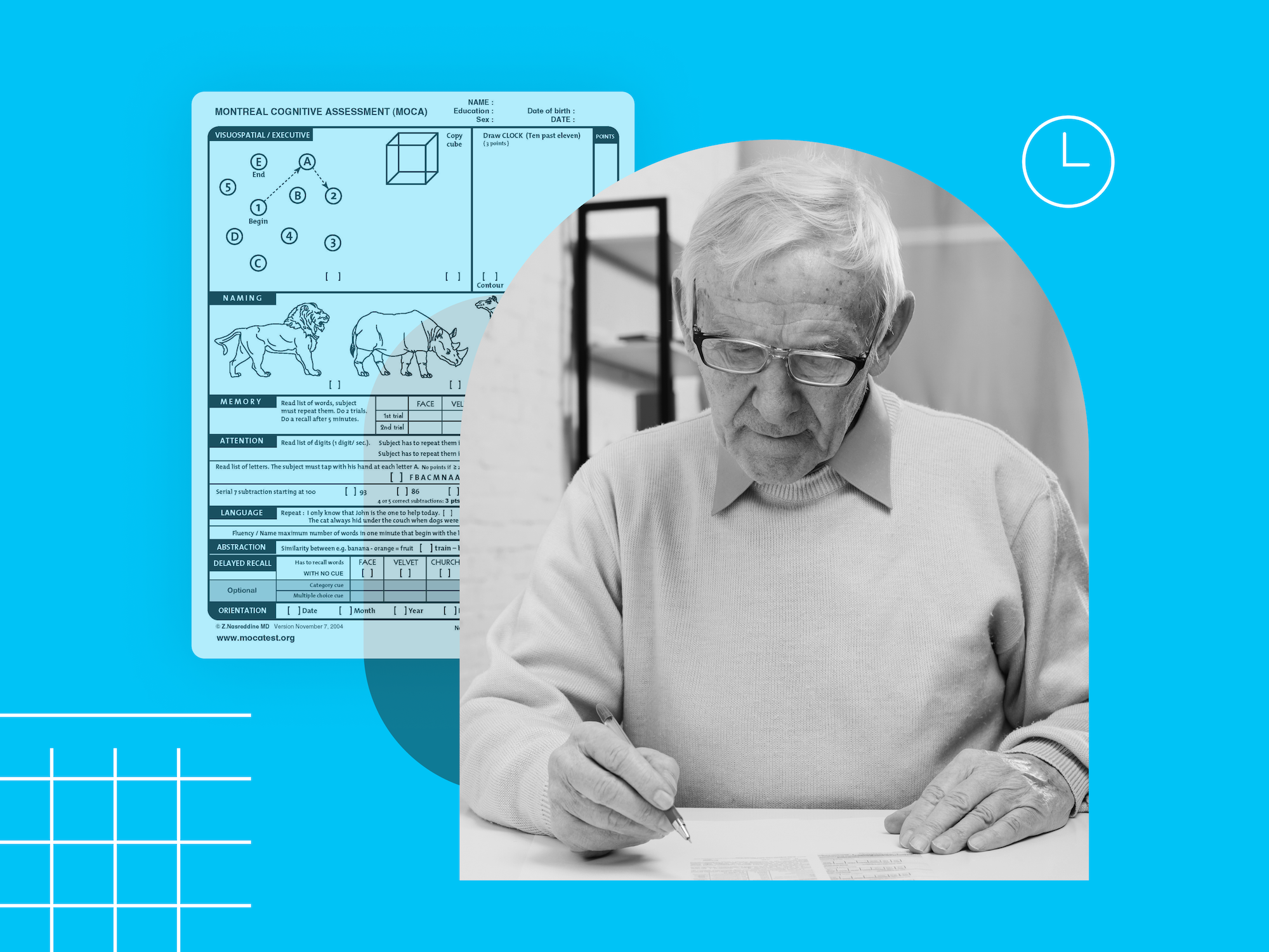 Sample MoCA test form showing sections for visuospatial/executive, naming, memory, attention, language, abstraction, delayed recall, and orientation
